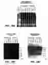 Fig. 22 - Achaete-Scute Like-2 Polypeptides and Encoding Nucleic Acids and Methods for the Diagnosis and Treatment of Tumor