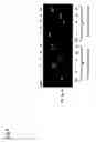 Fig. 07 - Method for detection and quantification of T-cell receptor Vβ  repertoire