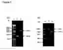Fig. 02 - Allelic variants of GPR50