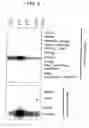 Fig. 02 - Kidney-specific urate transporter and gene thereof
