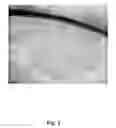 Fig. 02 - Methods for clonal derivation of human blastocyst-derived stem cell lines