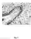 Fig. 08 - Methods for clonal derivation of human blastocyst-derived stem cell lines