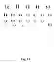 Fig. 11 - Methods for clonal derivation of human blastocyst-derived stem cell lines