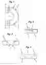 Fig. 02 - Reducing facial aging and appliance therefor