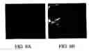 Fig. 09 - Vigilant cells