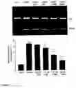 Fig. 07 - Methods of suppression of rage gene expression and rage triggered inflammatory genes by selected age-inhibitors