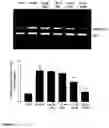 Fig. 09 - Methods of suppression of rage gene expression and rage triggered inflammatory genes by selected age-inhibitors