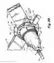 Fig. 24 - Fluid impervious gel barrier