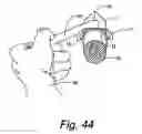 Fig. 29 - Fluid impervious gel barrier