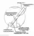 Fig. 01 - Methods and apparatus for intraocular brachytherapy