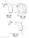 Fig. 02 - In the ear auxiliary microphone system for behind the ear hearing prosthetic
