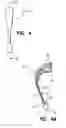 Fig. 04 - In the ear auxiliary microphone system for behind the ear hearing prosthetic