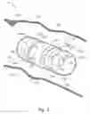 Fig. 03 - Method of assembling an in-vivo imaging device