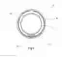 Fig. 05 - Endoscope