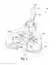 Fig. 03 - Retractor and methods of use