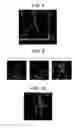 Fig. 09 - Methods and systems for iteratively identifying vascular structure