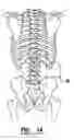 Fig. 09 - EMG electrode apparatus and positioning system