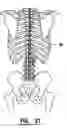 Fig. 16 - EMG electrode apparatus and positioning system