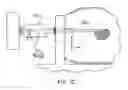 Fig. 09 - Surgical site marker delivery system