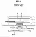 Fig. 02 - Pulsimeter sensor using magnetic thin films