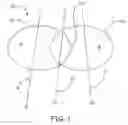 Fig. 02 - Method and apparatus for impedance signal localizations from implanted devices