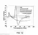Fig. 13 - Automated stimulus artifact removal for nerve conduction studies