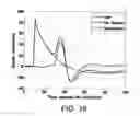 Fig. 16 - Automated stimulus artifact removal for nerve conduction studies