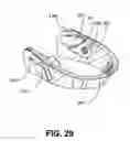 Fig. 41 - Cervical collar