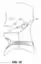 Fig. 44 - Cervical collar