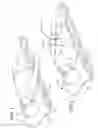 Fig. 02 - Arm positioning device