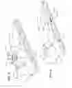 Fig. 03 - Arm positioning device