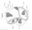Fig. 05 - Arm positioning device
