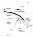 Fig. 02 - Glaucoma Implant Device