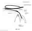 Fig. 09 - Glaucoma Implant Device