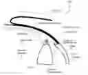 Fig. 01 - Glaucoma implant device