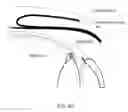 Fig. 07 - Glaucoma implant device