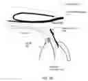Fig. 08 - Glaucoma implant device
