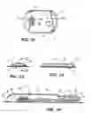 Fig. 08 - Device with anchoring elements for transdermal delivery or sampling of agents