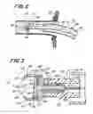 Fig. 03 - System and method of use for revascularizing stenotic bypass grafts and other blood vessels