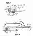 Fig. 04 - System and method of use for revascularizing stenotic bypass grafts and other blood vessels