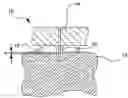 Fig. 01 - Intradermal delivery device