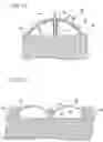 Fig. 08 - Intradermal delivery device