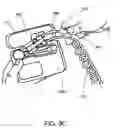 Fig. 12 - Method and apparatus for controlled feeding of an infant
