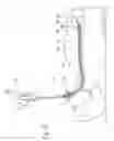 Fig. 30 - Systems and methods employing a bite block insert for positioning and stabilizing external instruments deployed within the body