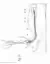Fig. 32 - Systems and methods employing a bite block insert for positioning and stabilizing external instruments deployed within the body