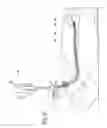 Fig. 33 - Systems and methods employing a bite block insert for positioning and stabilizing external instruments deployed within the body
