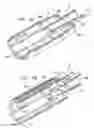 Fig. 05 - Automatic needle device