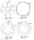 Fig. 10 - Cerebral perfusion augmentation