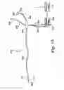 Fig. 12 - Cerebral perfusion augmentation