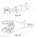 Fig. 15 - Cerebral perfusion augmentation